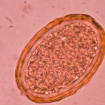 Worm Egg Count Machine: UPDATE!
